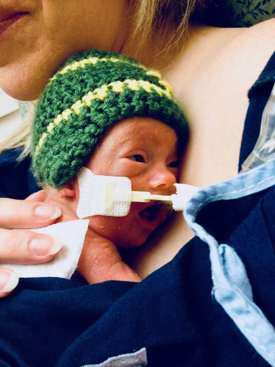 Tiny newborn baby wearing green hat and wire attached to his face held tight to mother's chest