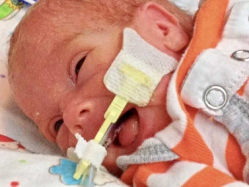 Newborn who won't live long on oxygen smiling 
