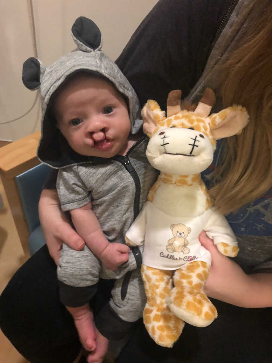 Twin with cleft pallet sits in mother's lap next to stuffed giraffe