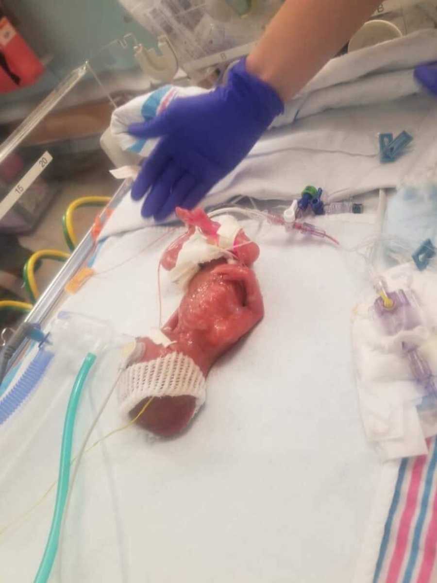 Hand with glove on beside preemie baby who didn't get to go home to show how small she was