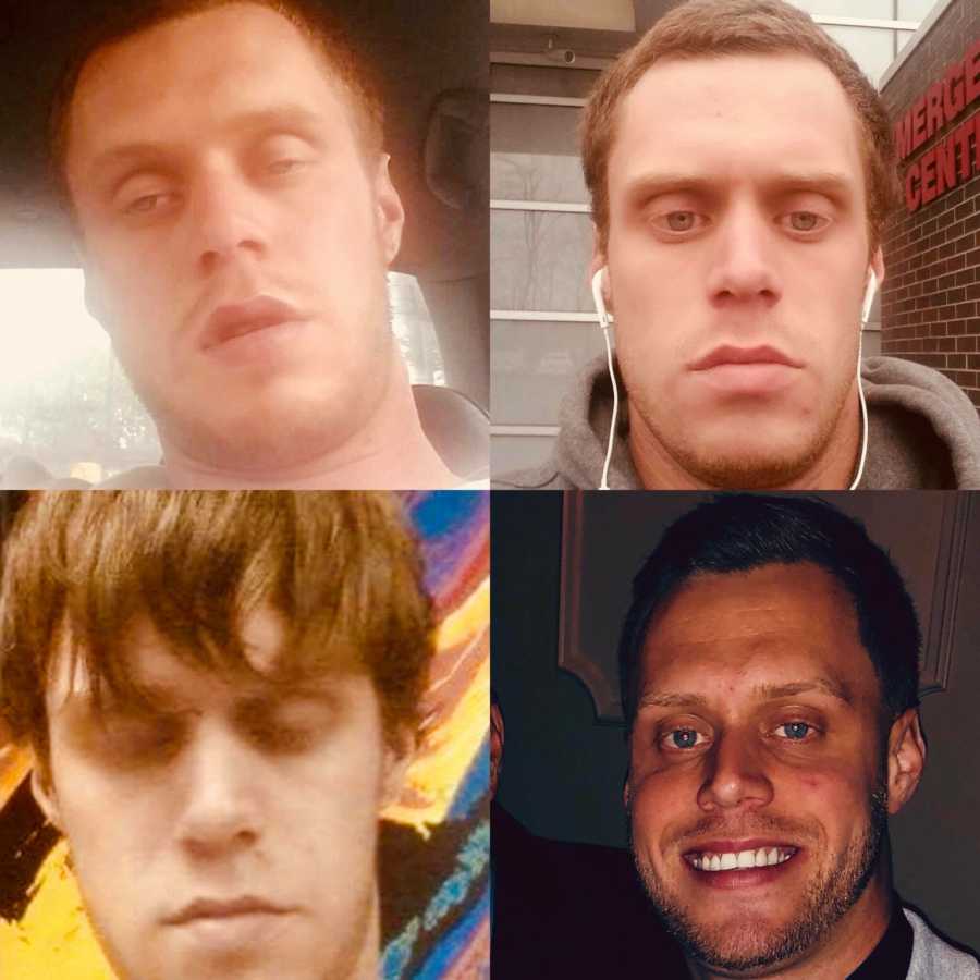Collage of man before during and after being a drug addict