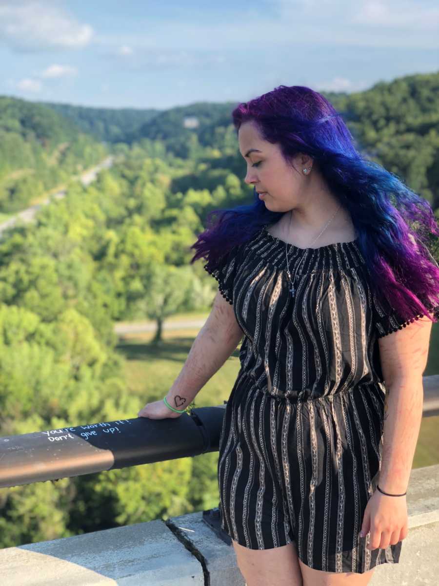 22 year old who has had over 20 suicide attempts stands with cuts all over her arm 