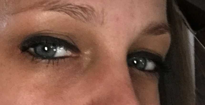 Close up of mother of three who recently became an addict's glassy eyes