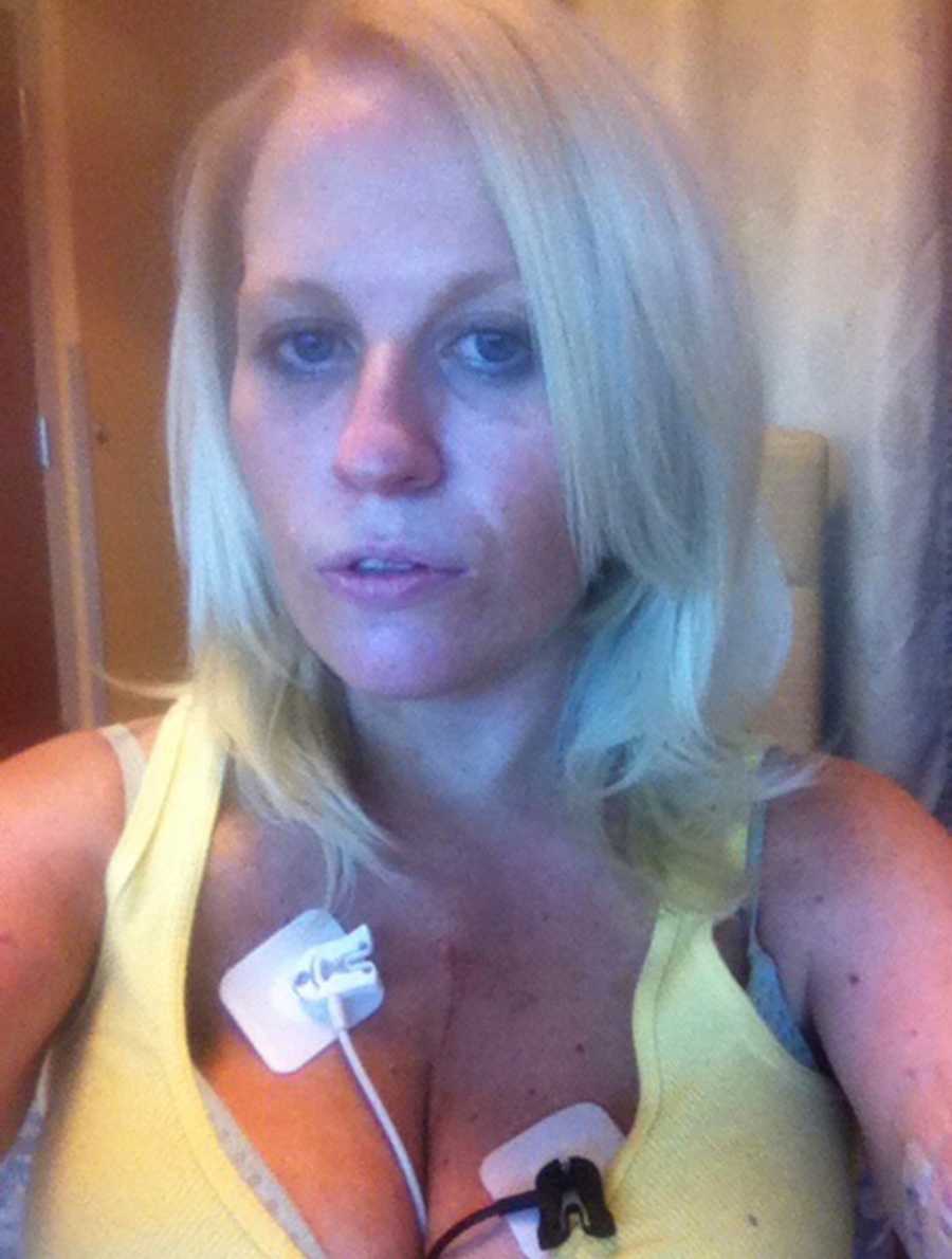 Pregnant woman who decided to become clean with patches on her chest for heart problem