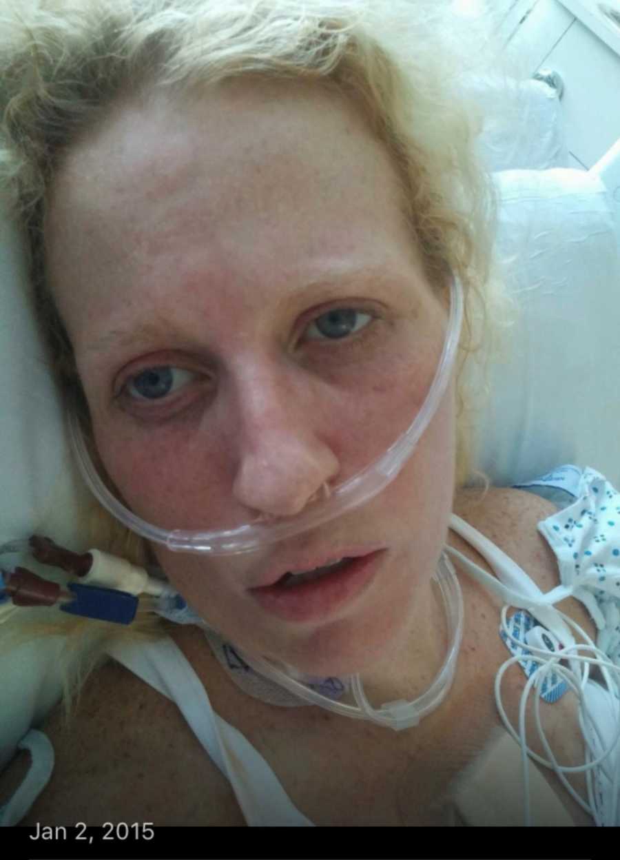 Close up of pregnant woman's face who is on oxygen and has been in hospital for 4 months for drug use