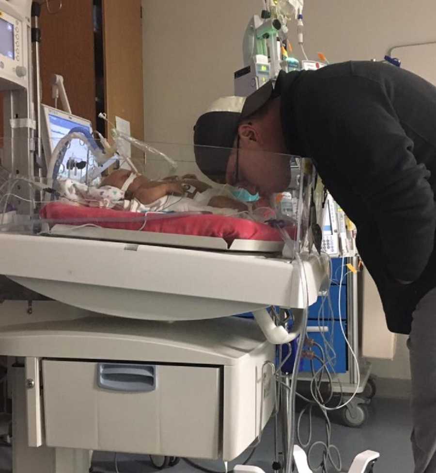 Father kisses newborn's toes in NICU who has chromosomal abnormalities