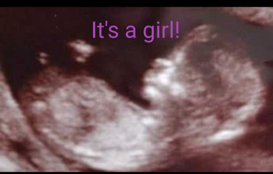 Ultrasound of baby girl with purple letters over it saying, "it's a girl!"