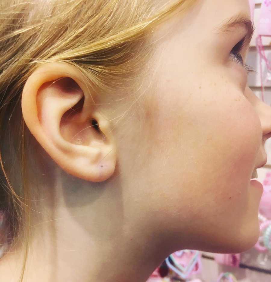 Close up of little girls ear that is about to be pierced 