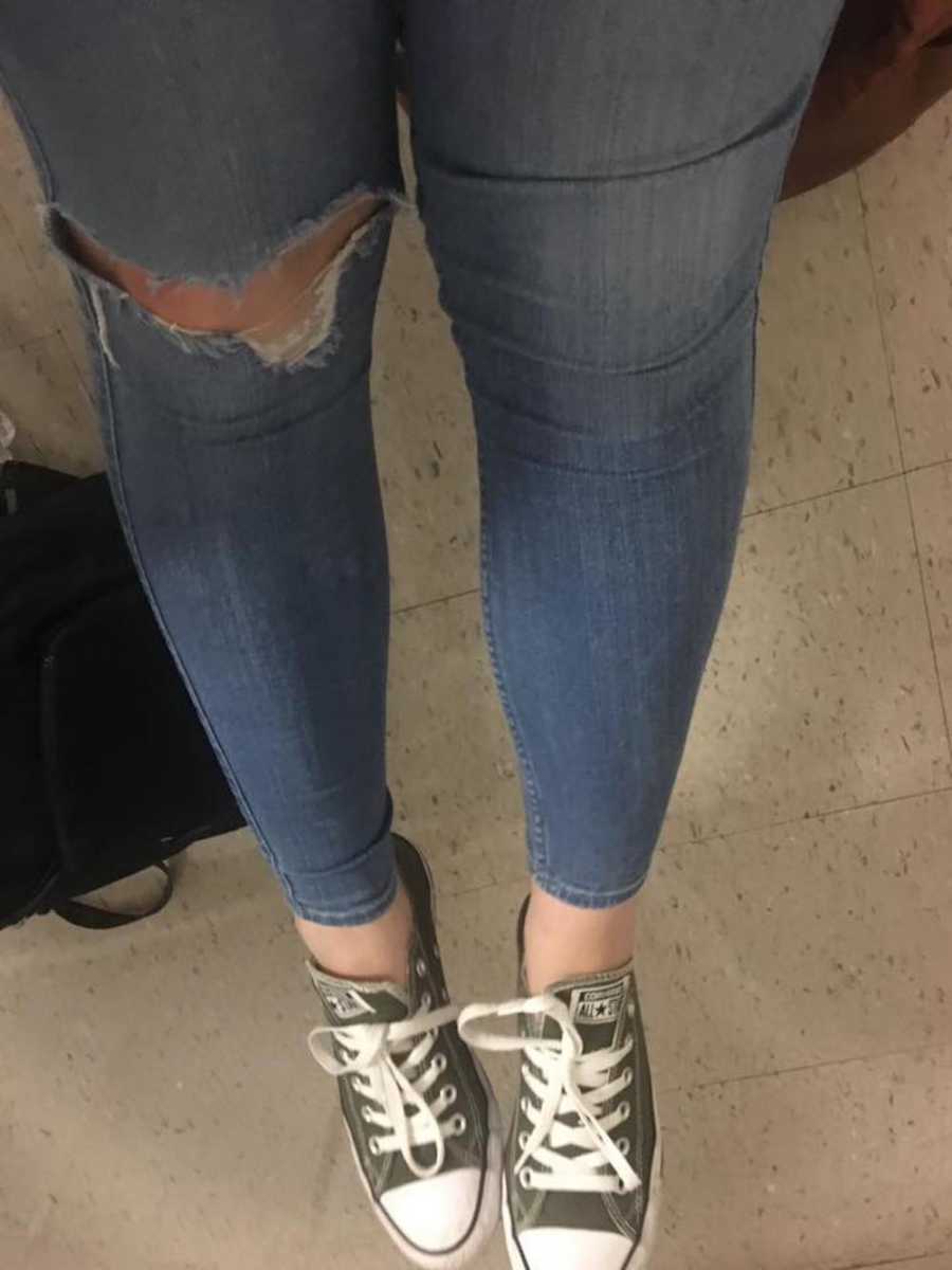 Legs of teen who got dress coded for having a hold in her jeans