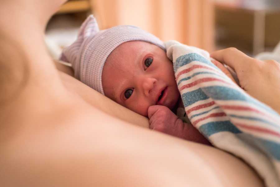 Close up of baby with Trisomy 18 lying on mother's bare chest