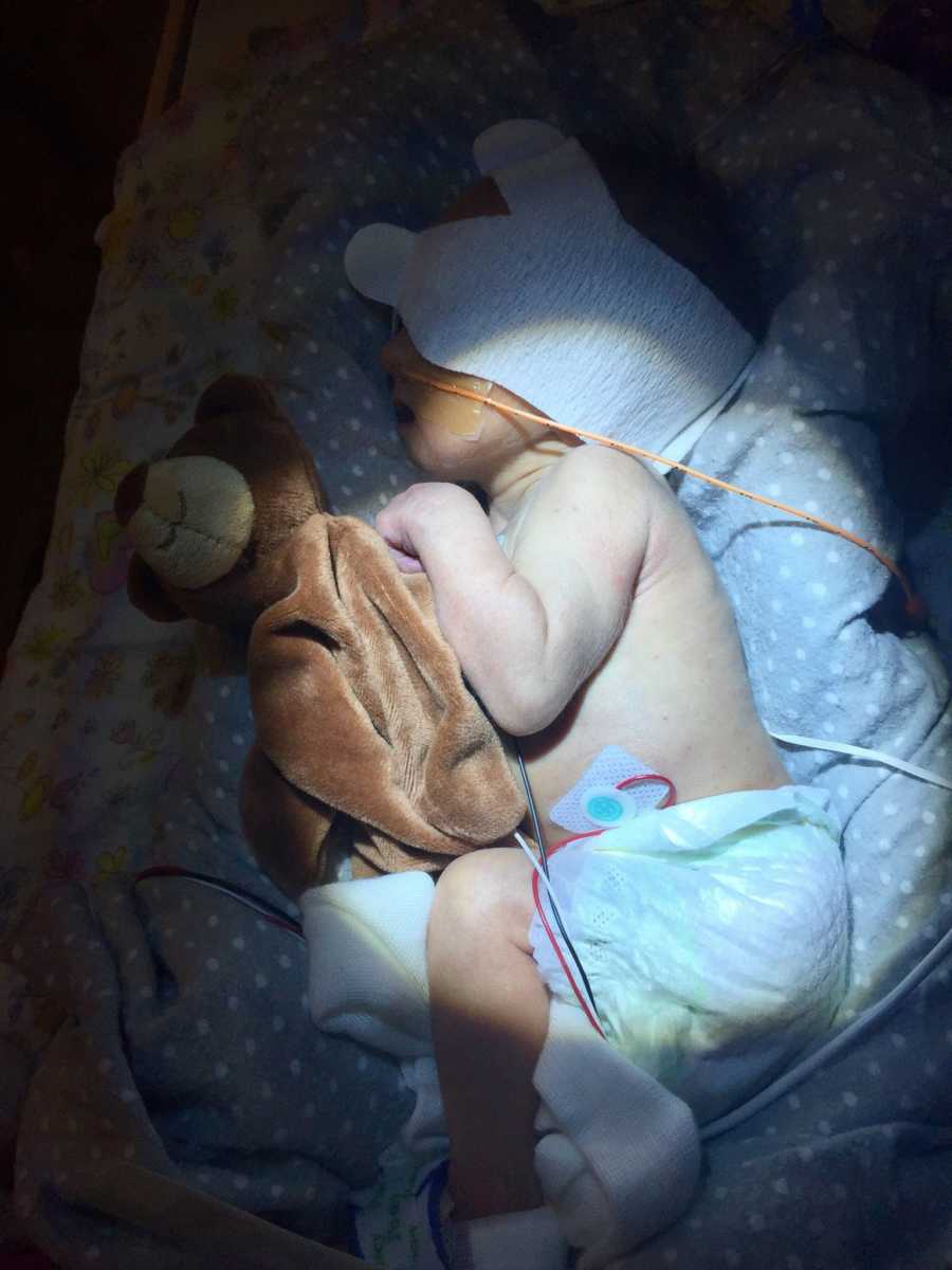 Newborn with Trisomy 18 lying in NICU with teddy bear