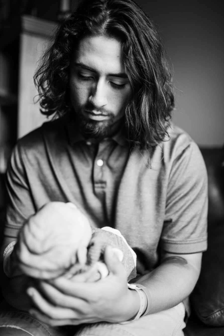 Father looks down at his son with Microcephaly in his arms