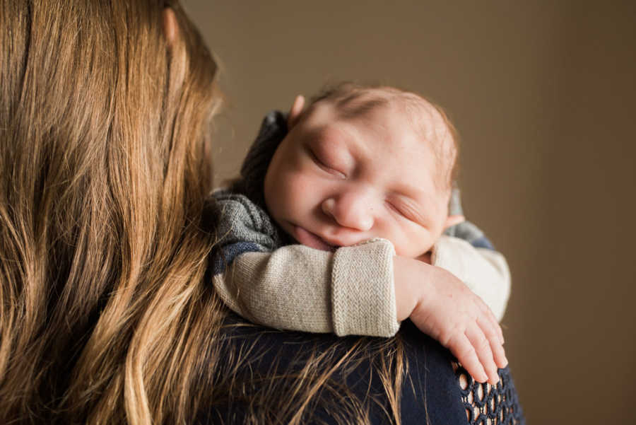 Close up of baby with Microcephaly resting head on mothers shoulder