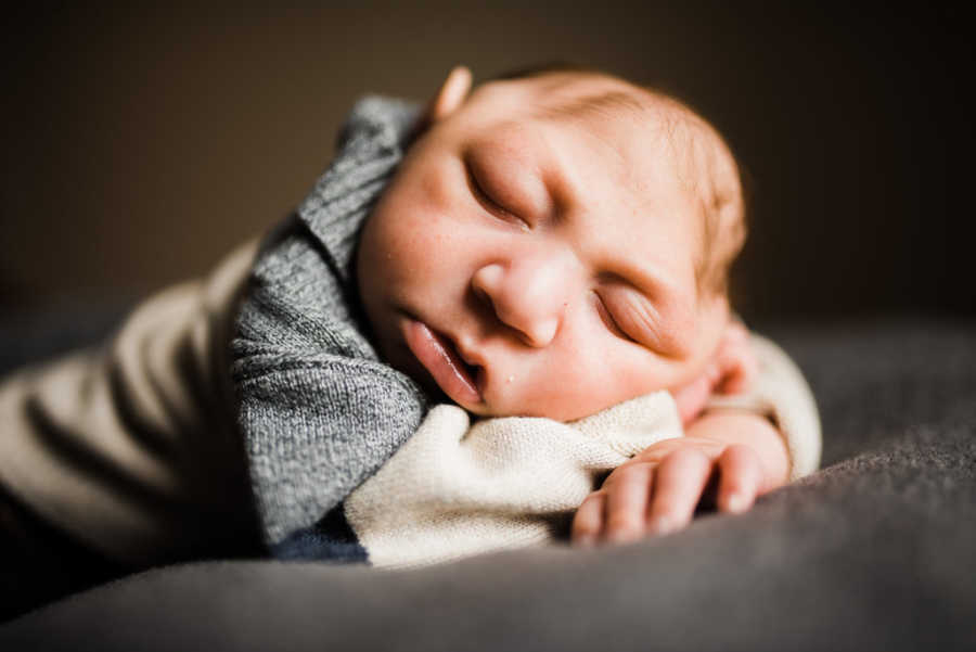 Baby with Microcephaly sleeping on crossed hands