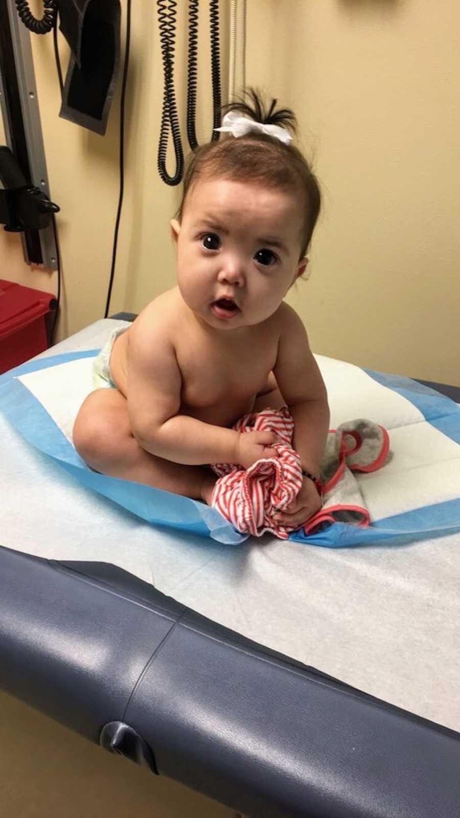 Infant with Axenfeld-Rieger syndrome sits on doctor's office bed with just a diaper on