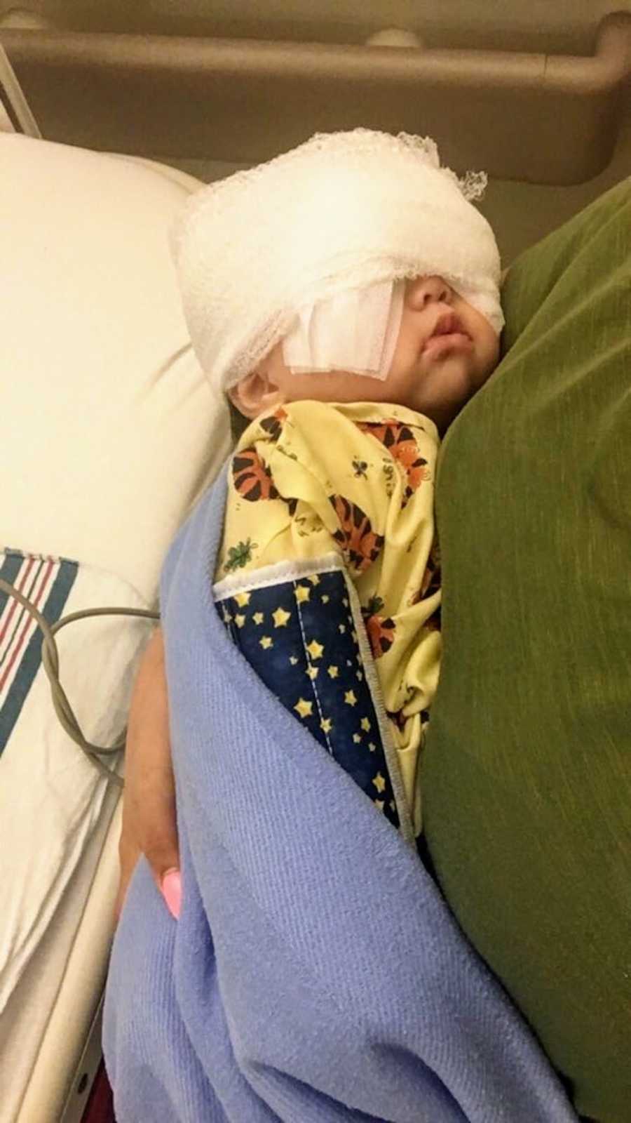 Mother holds infant with Axenfeld-Rieger syndrome in her arms whose eyes are wrapped in bandages
