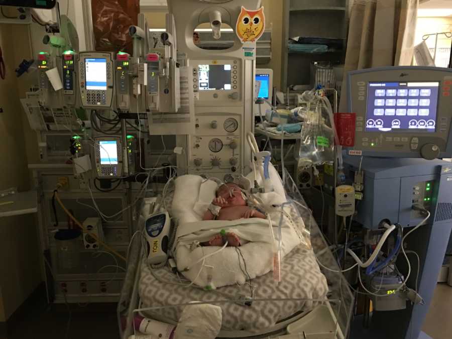 Newborn baby in NICU after surgery hooked up to monitors