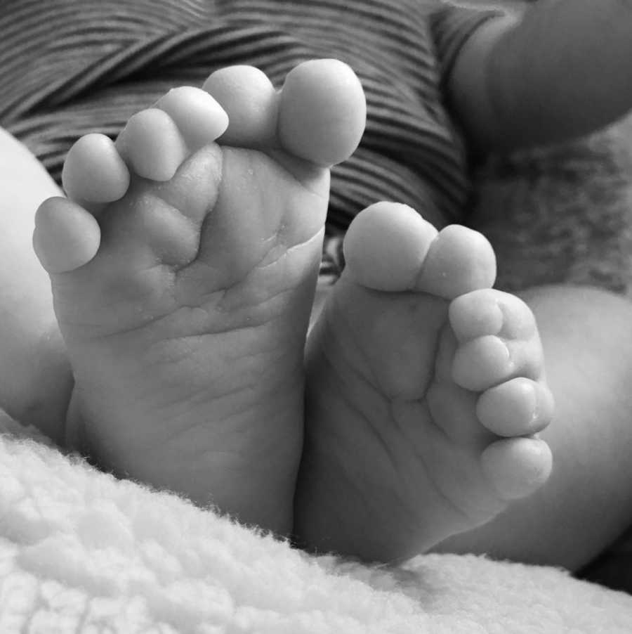 Close up of newborn's feet that has 12 toes total