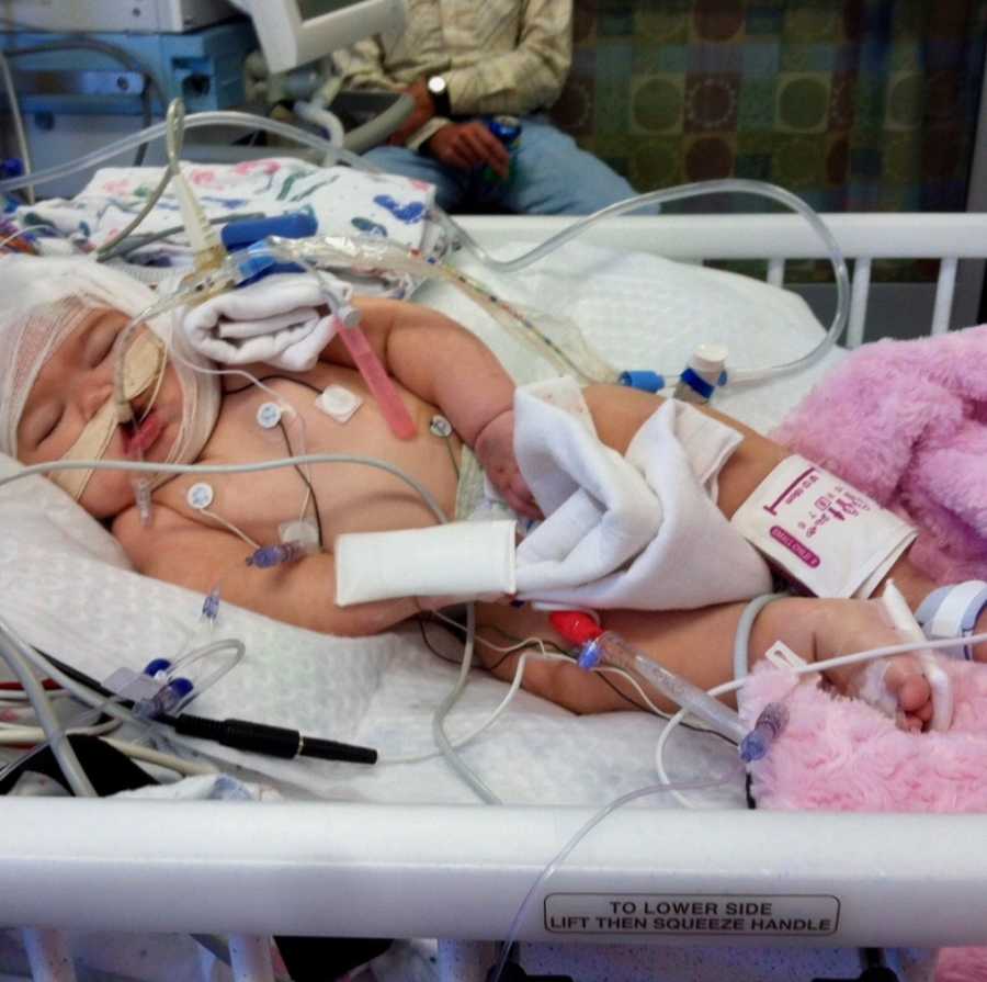 Baby with shaken baby syndrome lying in hospital bed after procedures
