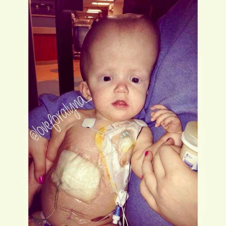 Newborn with terminal brain cancer sits in mothers lap with bandages all over her chest