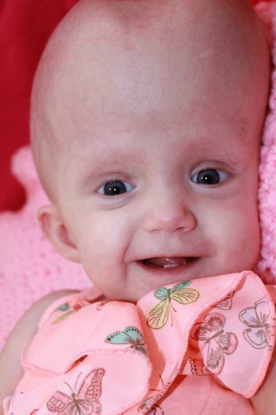 Baby who has terminal brain cancer smiles 