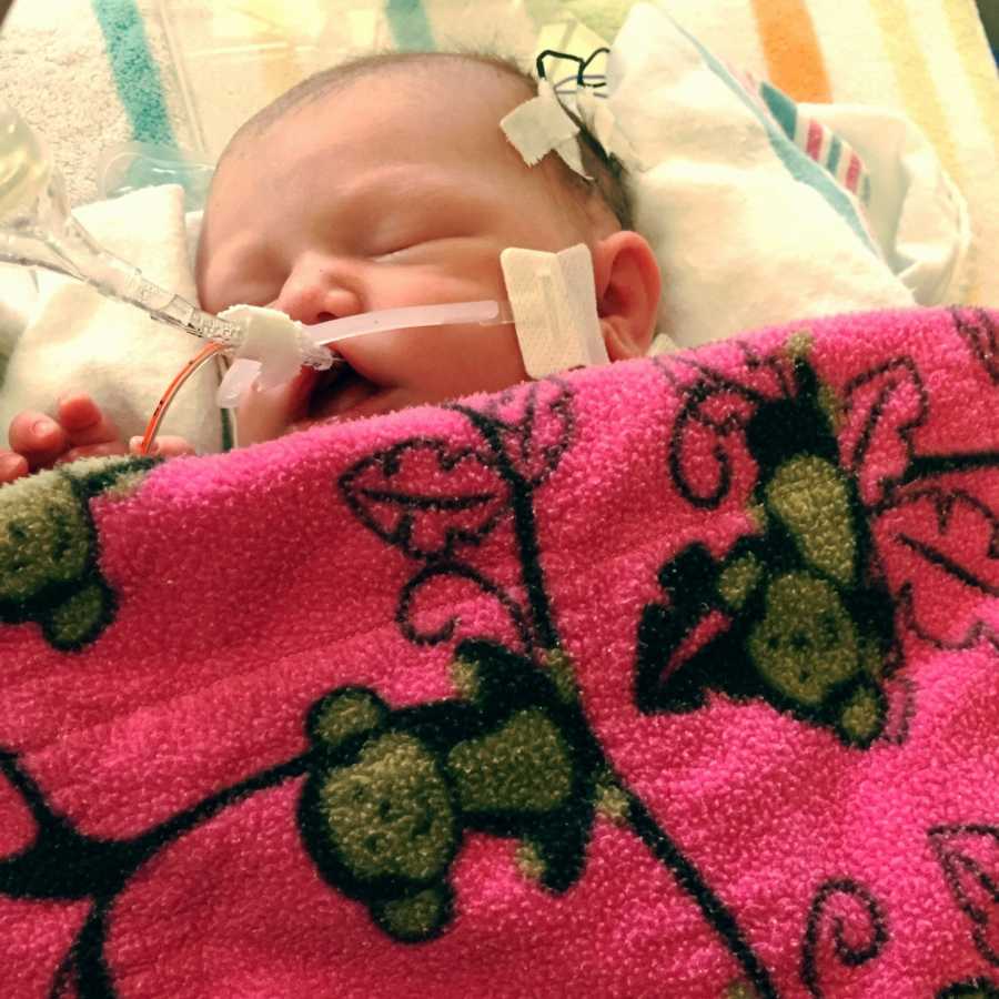 Newborn who had blood transfusion sleeps in NICU with tube in her mouth