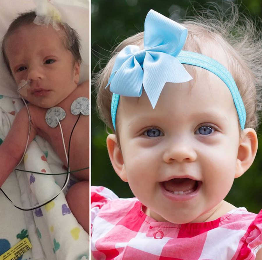 Side by side of toddler girl with blue bow in her hair next to her on the day she was born