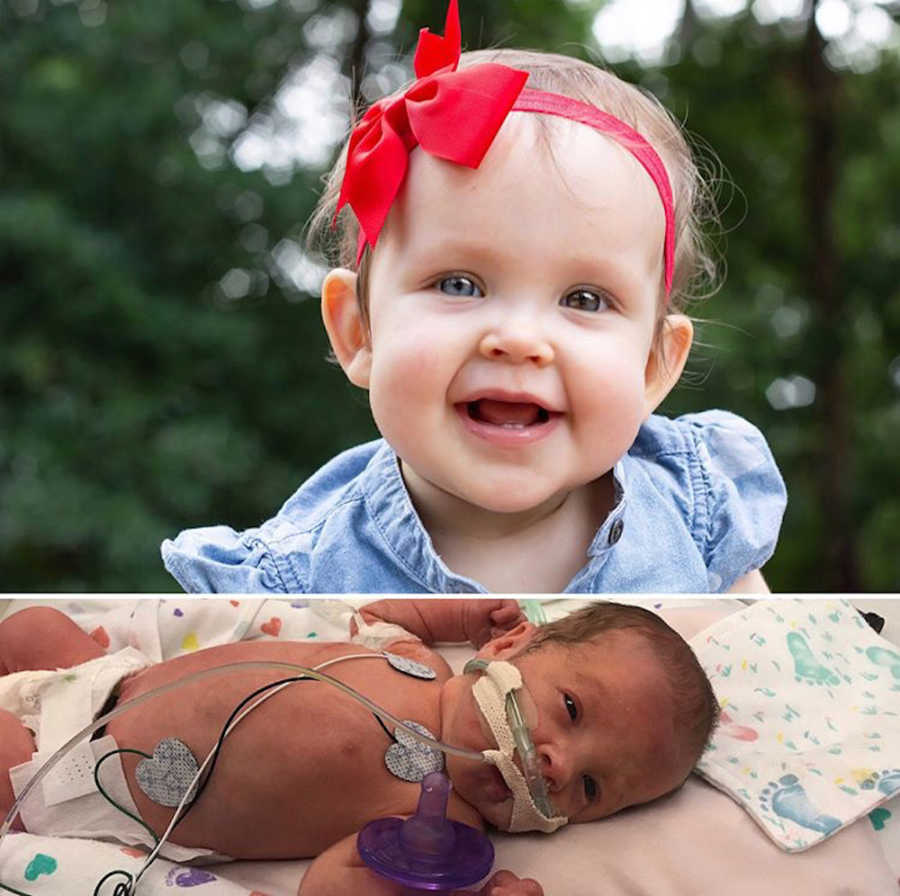 Side by side of toddler girl with red bow in her hair next to her on the day she was born