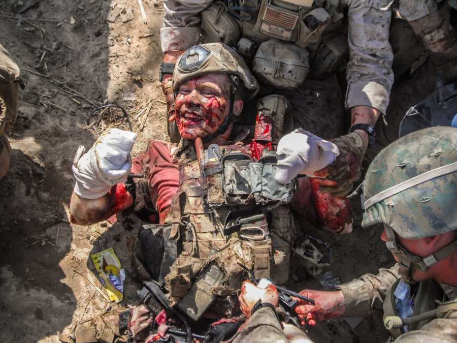 Injured soldier who is covered in blood smiles as other soldier tend to him