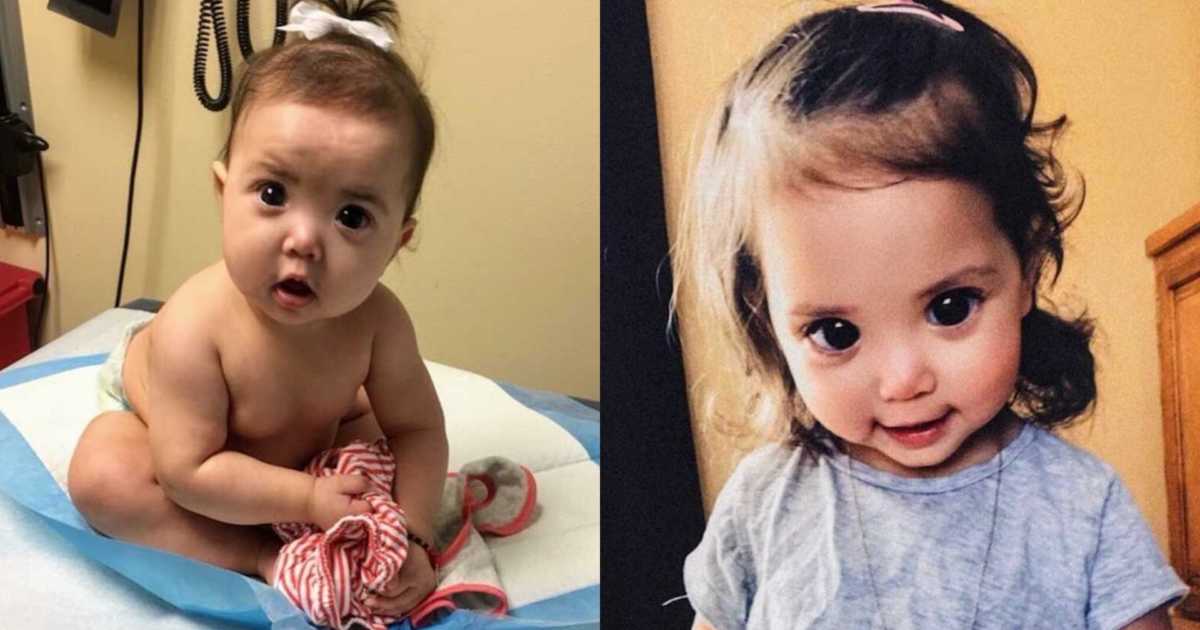 ‘Something was seriously wrong with our daughter’s eyes. They were mostly pupil!’: After ‘normal, healthy’ pregnancy, mom receives Axenfeld-Rieger diagnosis