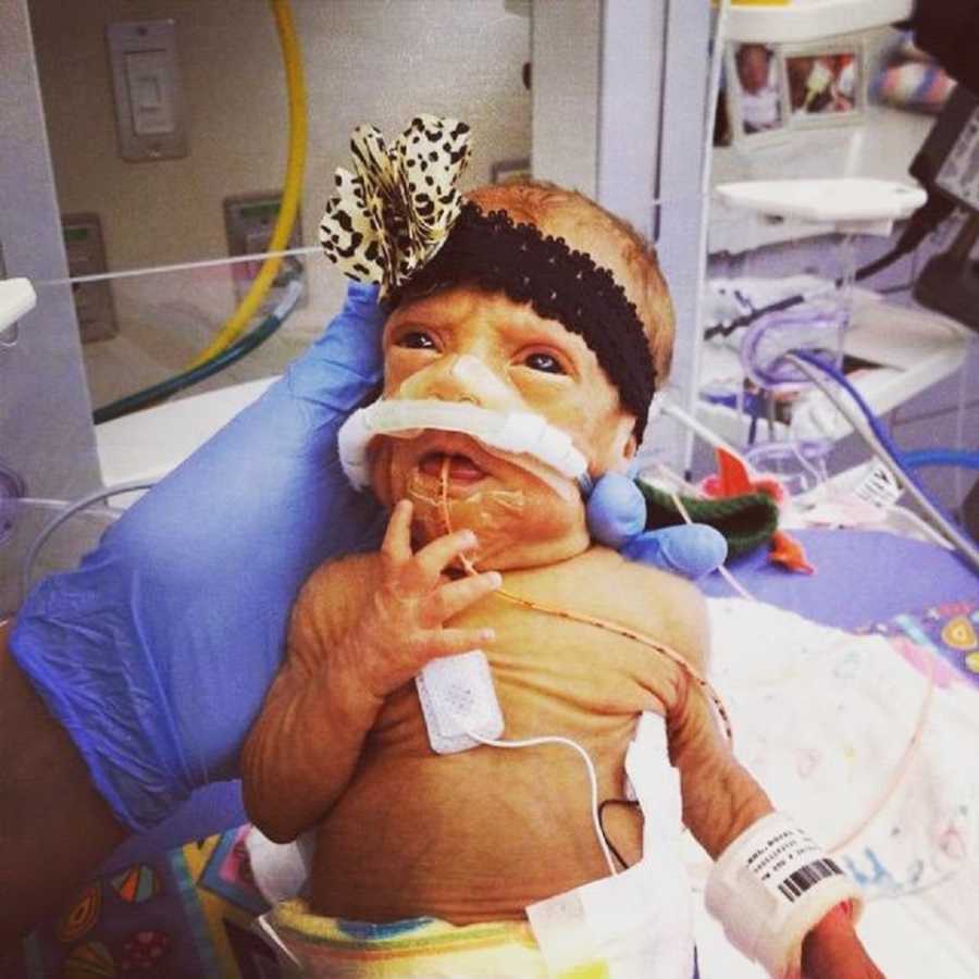 Hand with blue glove on holding preemie baby in NICU who has flower headband on