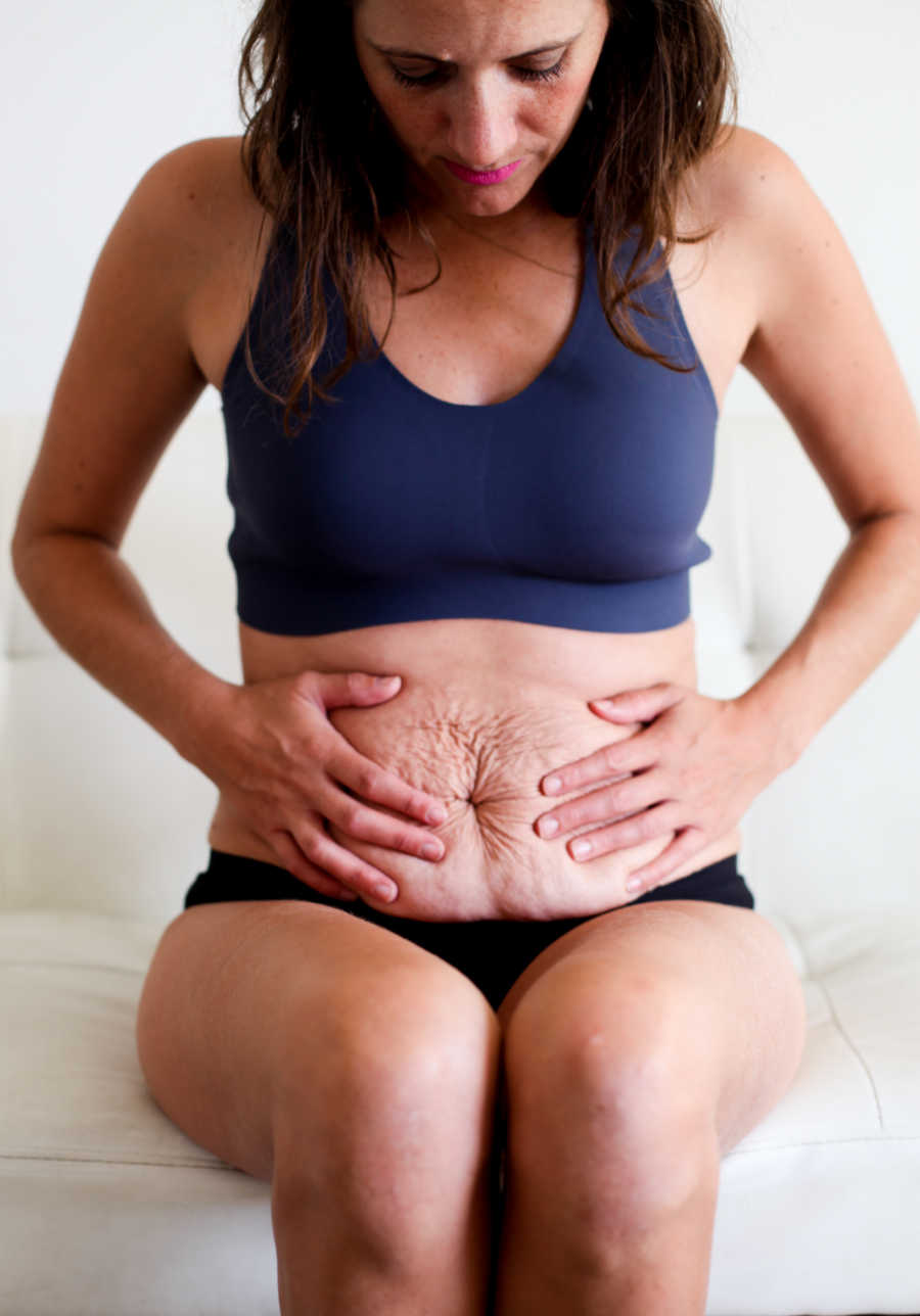 Woman sits in bra and underwear holding her stomach in a way to show postpartum marks