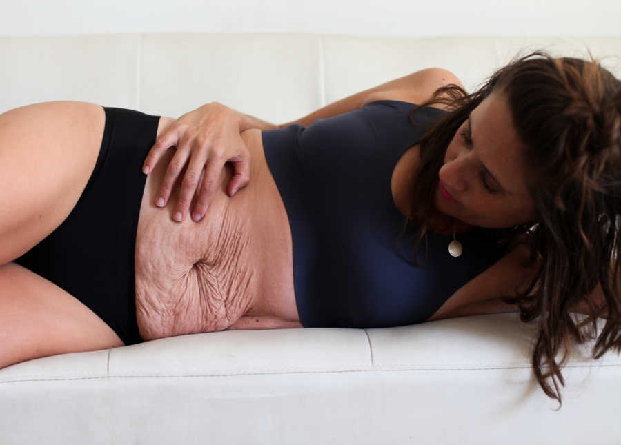 Woman in bra and underwear lays on her side holding stomach in a way to show postpartum marks