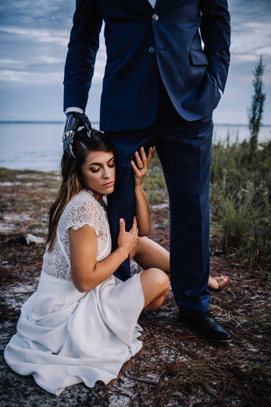 Bride sits on ground with limbs wrapped around husbands leg who also has bionic hand