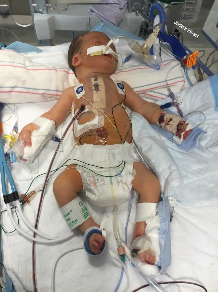 Baby with weak immune system lays in hospital bed hooked up to monitors 