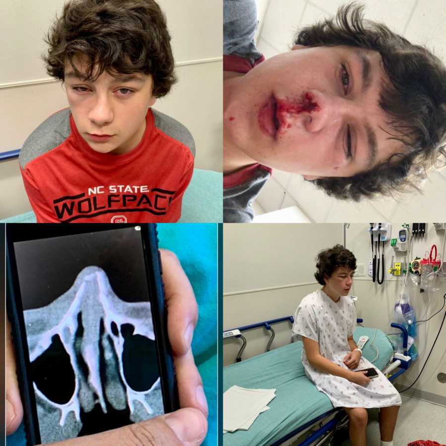 Collage of teen who was beat up in gym class and now in hospital