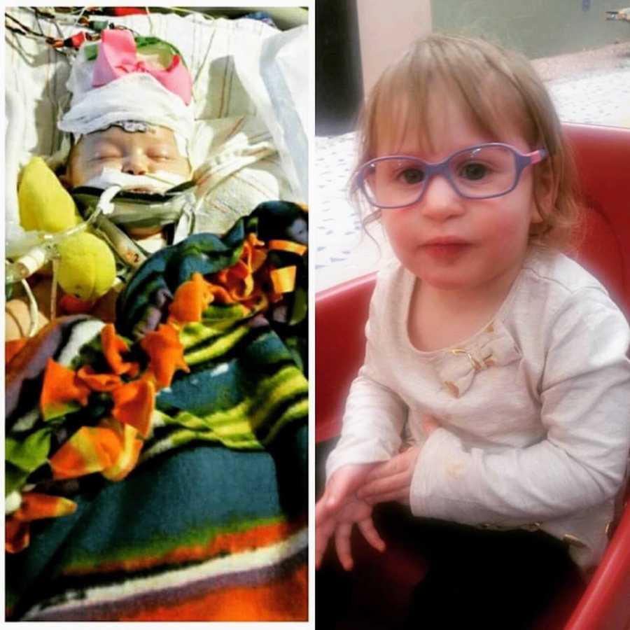Side by side of newborn in ICU after being physically abused beside her today as toddler