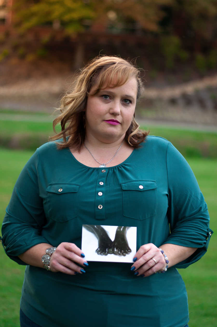 Woman who miscarried stands outside holding picture of baby feet in front of her