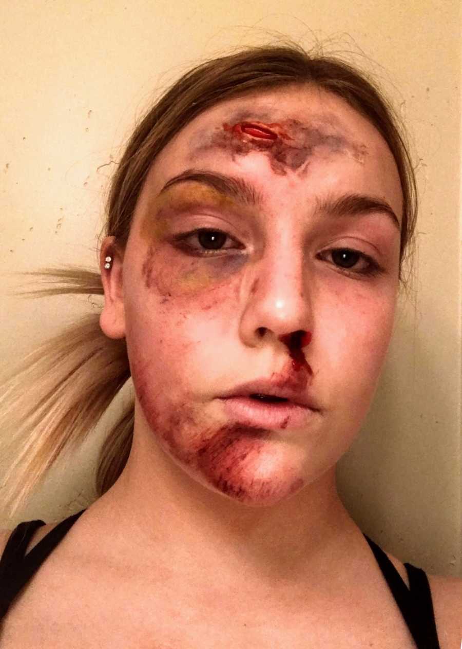 Teen's face who looks like it is beat up for Halloween