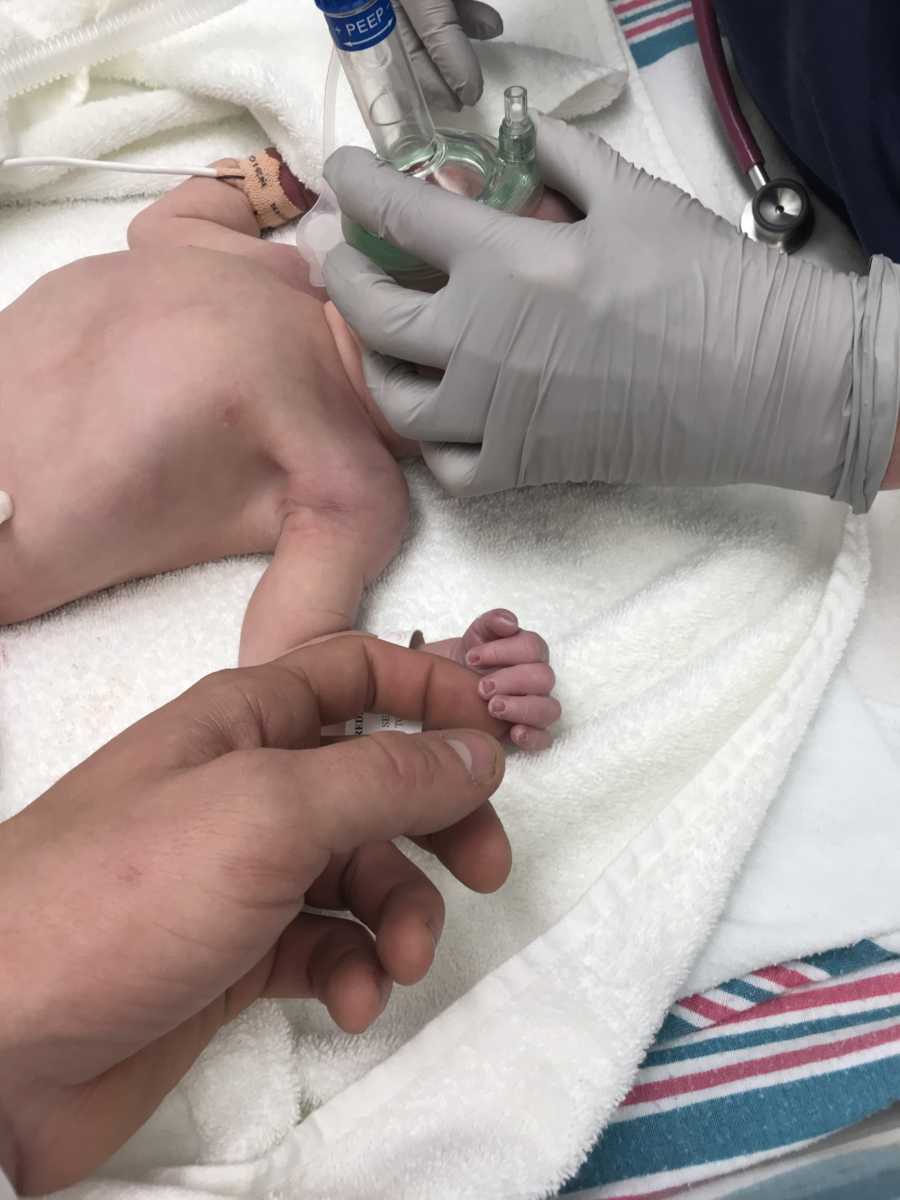 Newborn lies in NICU while doctor holds oxygen mask over his mouth