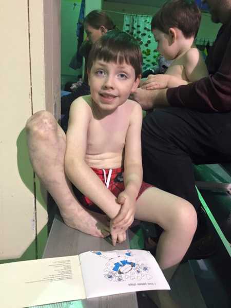 Young boy with CMTC smiling in swimsuit 