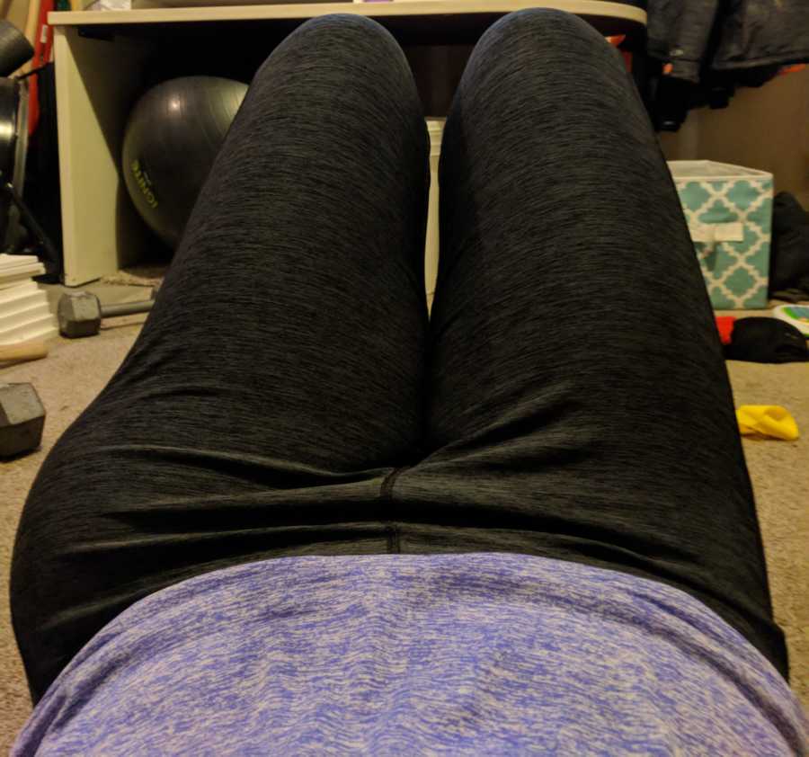 Woman with Sarcoma Cancer laying on floor in workout gear with large bump on her thigh
