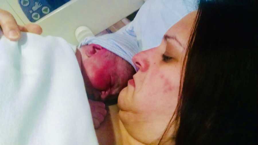 Woman lays in hospital looking down at newborn on her chest whose face is bright red