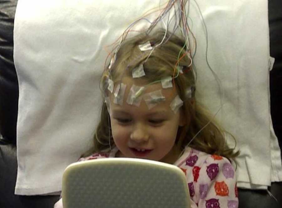 Little girl with absence and petit mal seizures smiles as she looks at her self in mirror seeing wires attached to her head
