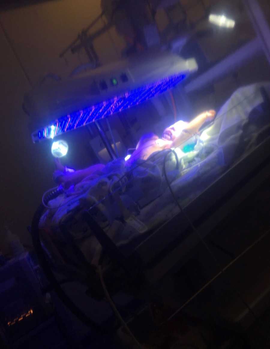 Newborn lays in NICU with light over him to help regulate his temperature