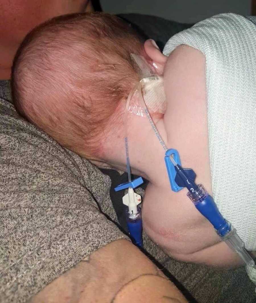 Baby lying on parent's chest with wires attached to his head at hospital