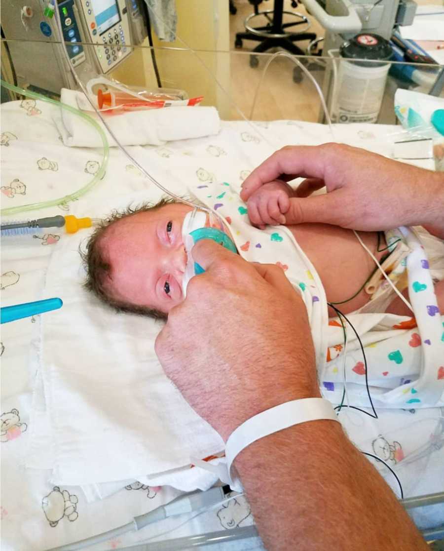 Father holds newborn with Pfeiffer Syndrome's hands as she lays in NICU