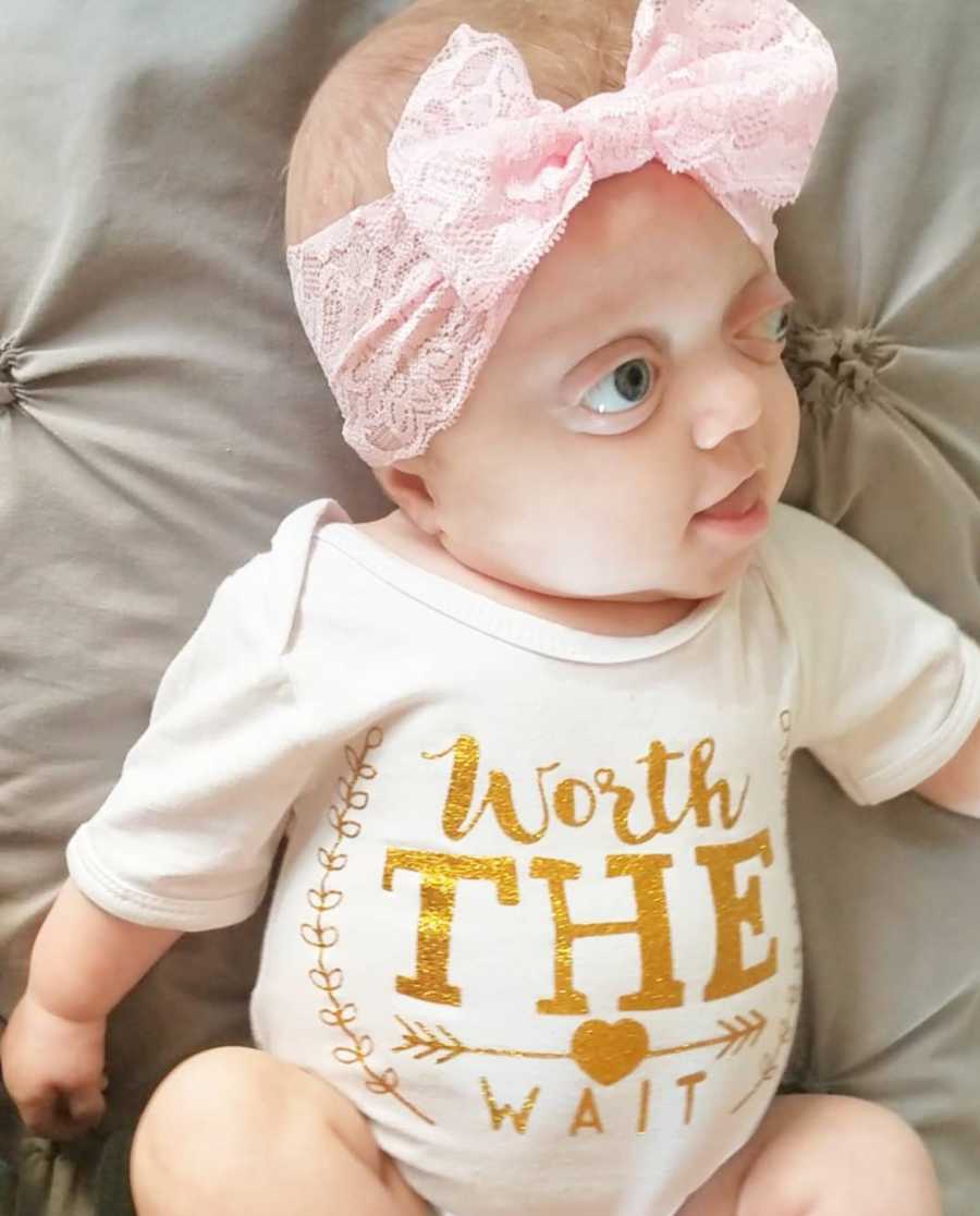 Baby with Pfeiffer Syndrome wearing onesie that says, "Worth the wait" and pink bow on head