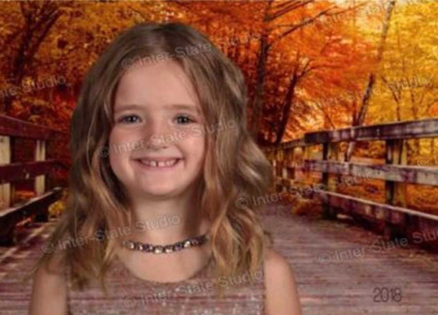 Little girl's head floating on bridge in woods from wearing green dress that blends in with green screen