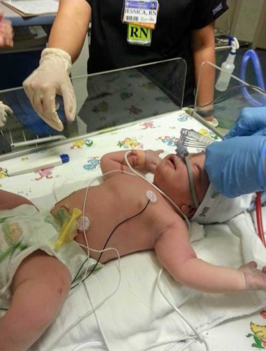 Newborn lays in NICU while nurse holds machine to his nose